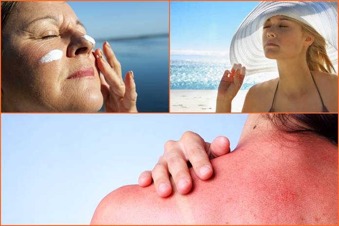 Saulė – vitamino D šaltinis, tačiau gali sukelti rimtų susirgimų: kaip išvengti žalingo saulės poveikio odai